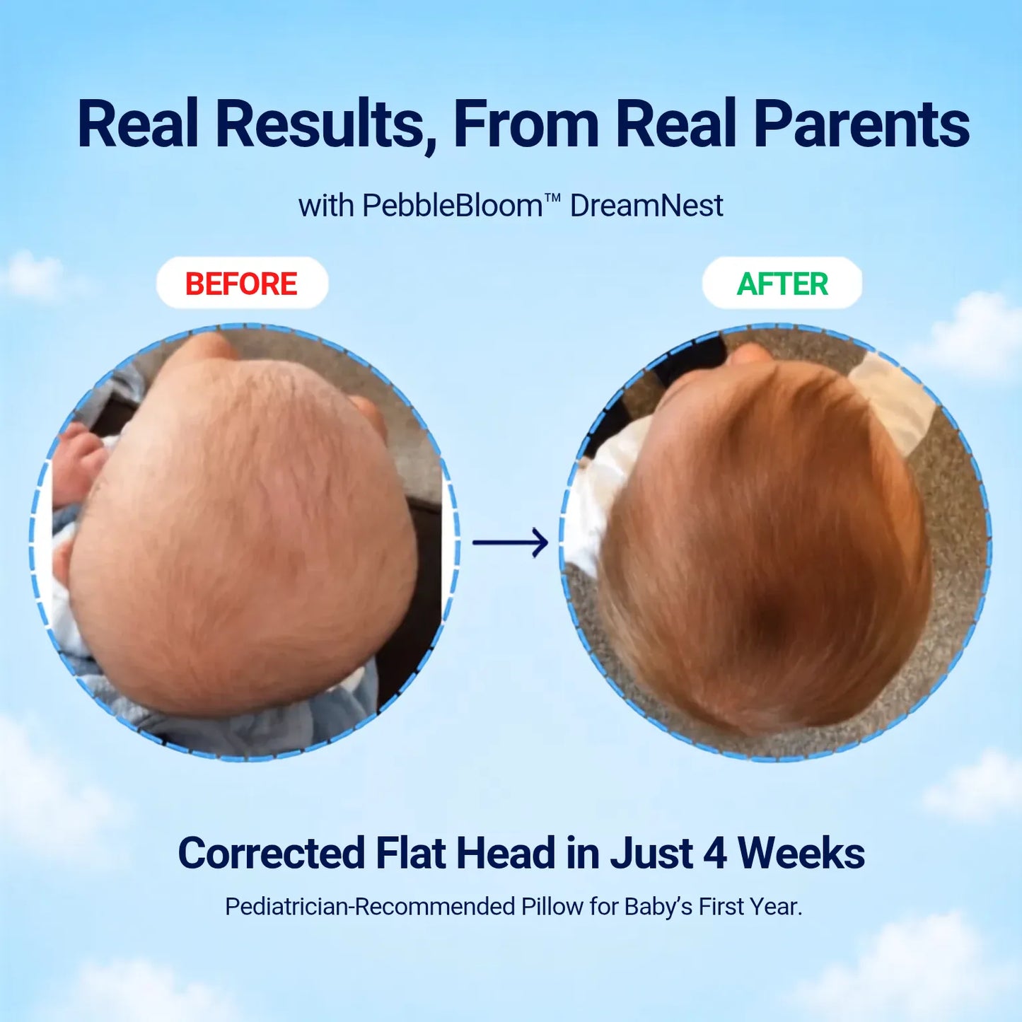 PebbleBloom™ Head Shaping Pillow